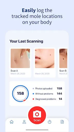 AI Dermatologist: Skin Scanner