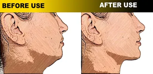 Jaw Muscles Exercises - Redefi