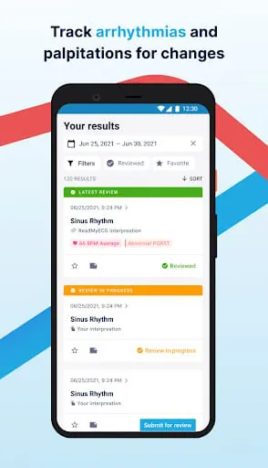 Qaly | ECG Reader