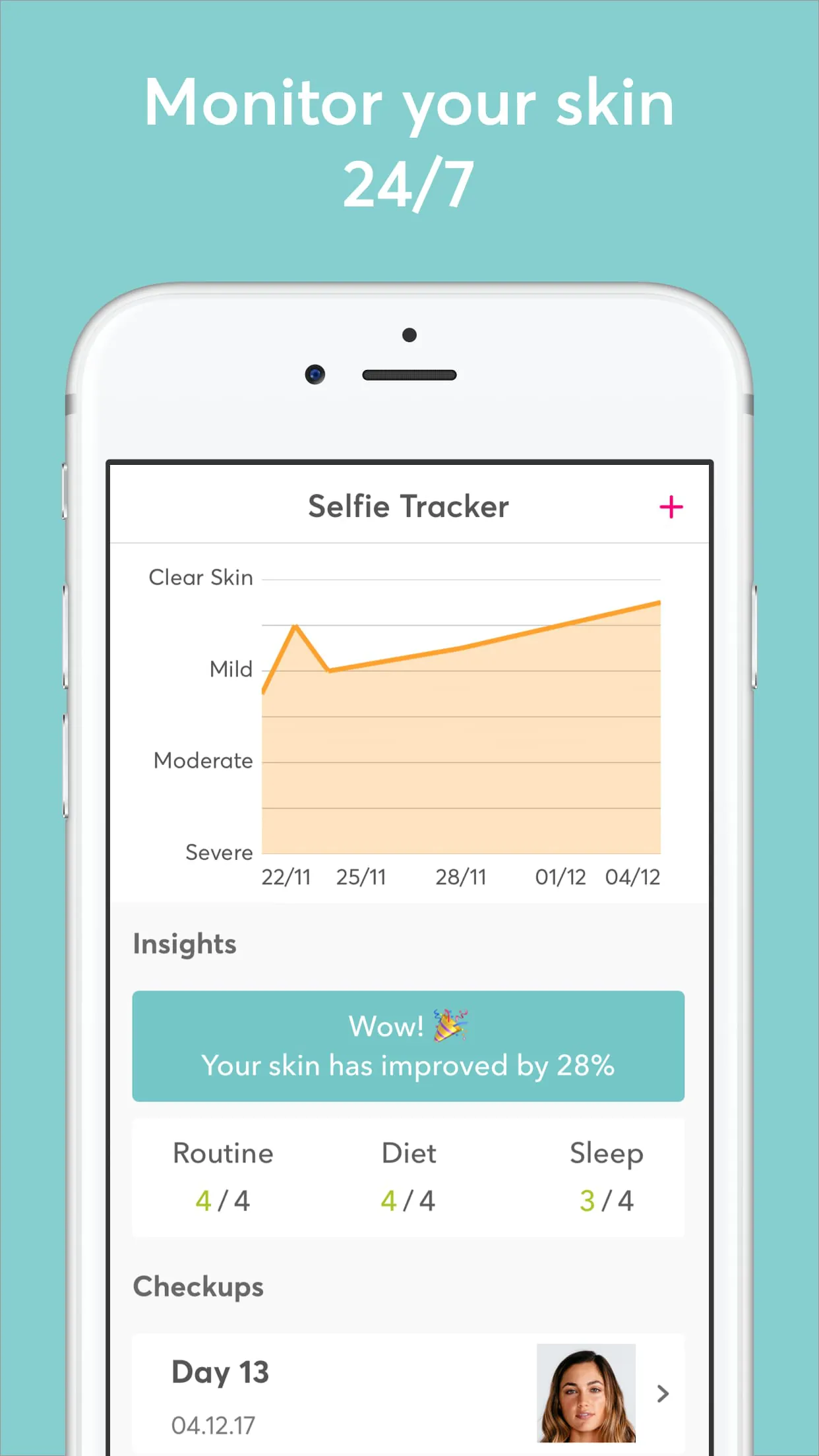 MDacne - Custom Acne Treatment