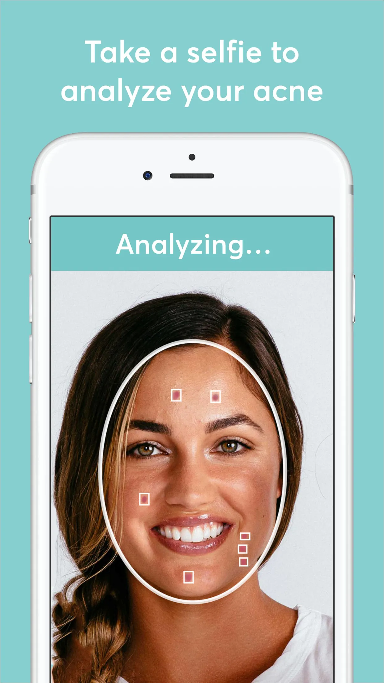 MDacne - Custom Acne Treatment