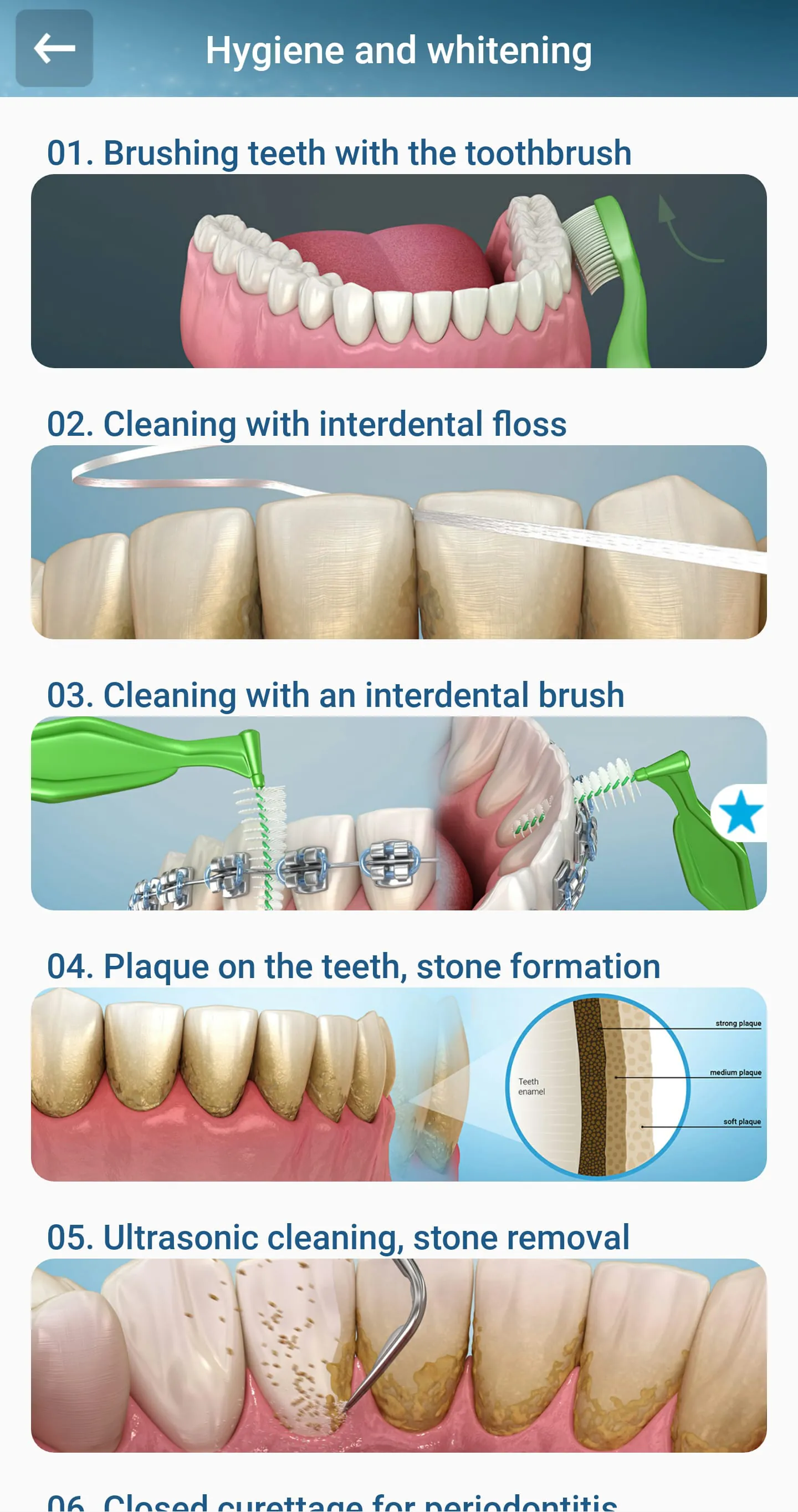 Dental 3D Illustrations