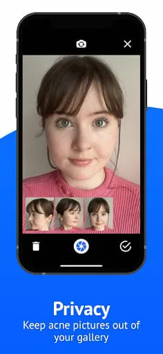 SkinTheory Skin + Acne Tracker